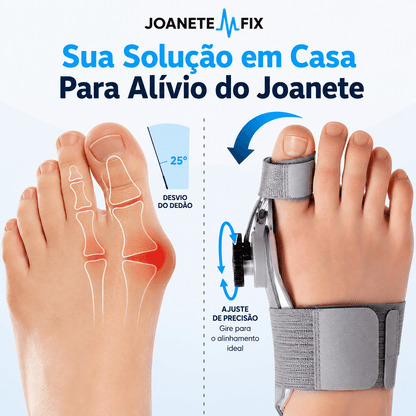 Joanete Fix